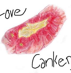 Love Cankers